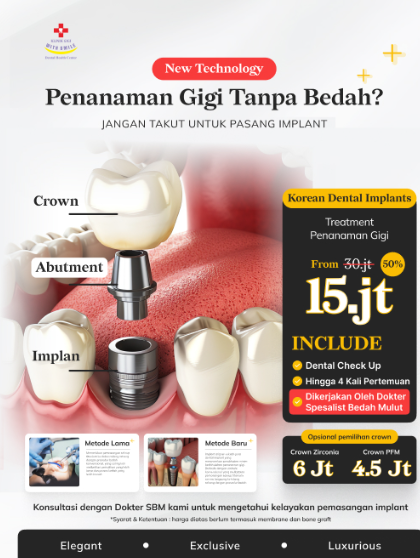 Bedah mulut tanam gigi Penanaman gigi with smile dental